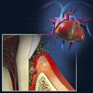 Biofilms: The Oral-Systemic Connection eBook Thumbnail