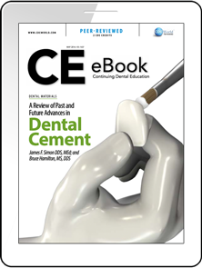 A Review of Past and Future Advances in Dental Cement eBook Thumbnail