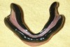 Fig 2. Mandibular custom tray border-molded with low-fusing compound (photograph courtesy of Carl Hansen, DDS).