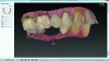 Fig 5. Final open system intraoral STL file.