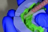 Fig 3 and Fig 4. Fabrication of the provisional; injecting the material.