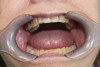 (1.) Large and scalloped tongue.