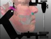 Fig 6. Screen capture of digitalized photorealistic 3D image used for face-in planning of posterior edentulous areas with virtual articulation.