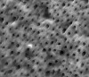 Fig 10. Dentin specimen with air abrasion after etching, at higher magnification.