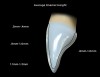 (3.) Average enamel depth of different areas of a central incisor.