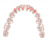 (2.) Ideal occlusal design showing posterior occlusal contacts with anterior and canine guidance. guidance. Images adapted from content developed by The Dawson Academy.