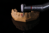 (4.) The tooth on the model was prepared for a traditional crown with the gingival margins ideally placed.