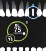 (16.) Because the implant’s ISQ value was above 65, immediate provisionalization could be performed with relative confidence.