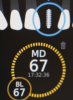 (37.) The implant’s primary stability was assessed by RFA, and the ISQ value greater than 65 was used to determine that immediate provisionalization was indicated.