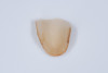 (3.) Fractured ceramic piece of the upper lateral incisor showing adhesive and cement remnants on the inner surface. (4. and 5.) At 100X magnification, the glass beads