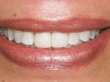 Figure 1a  Normal color vision and different types of color deficiency: (A) Original image.