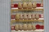 Figure 12  A tooth from an extra denture set that fits the space can be molded into position by using red rope wax.