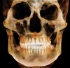 Figure 1  A 3-dimensional view.