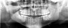Figure 2  Example of grey scale.